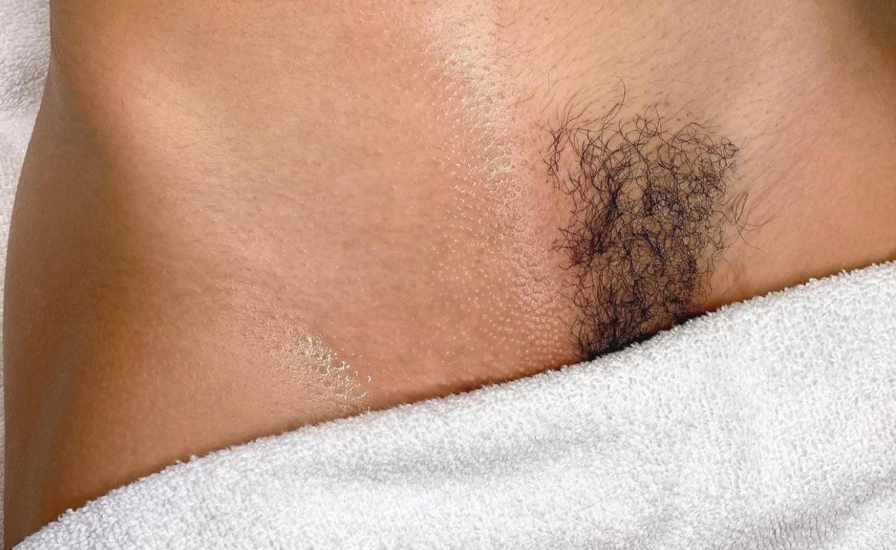 unnamed image